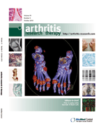 gout impact arthritis research